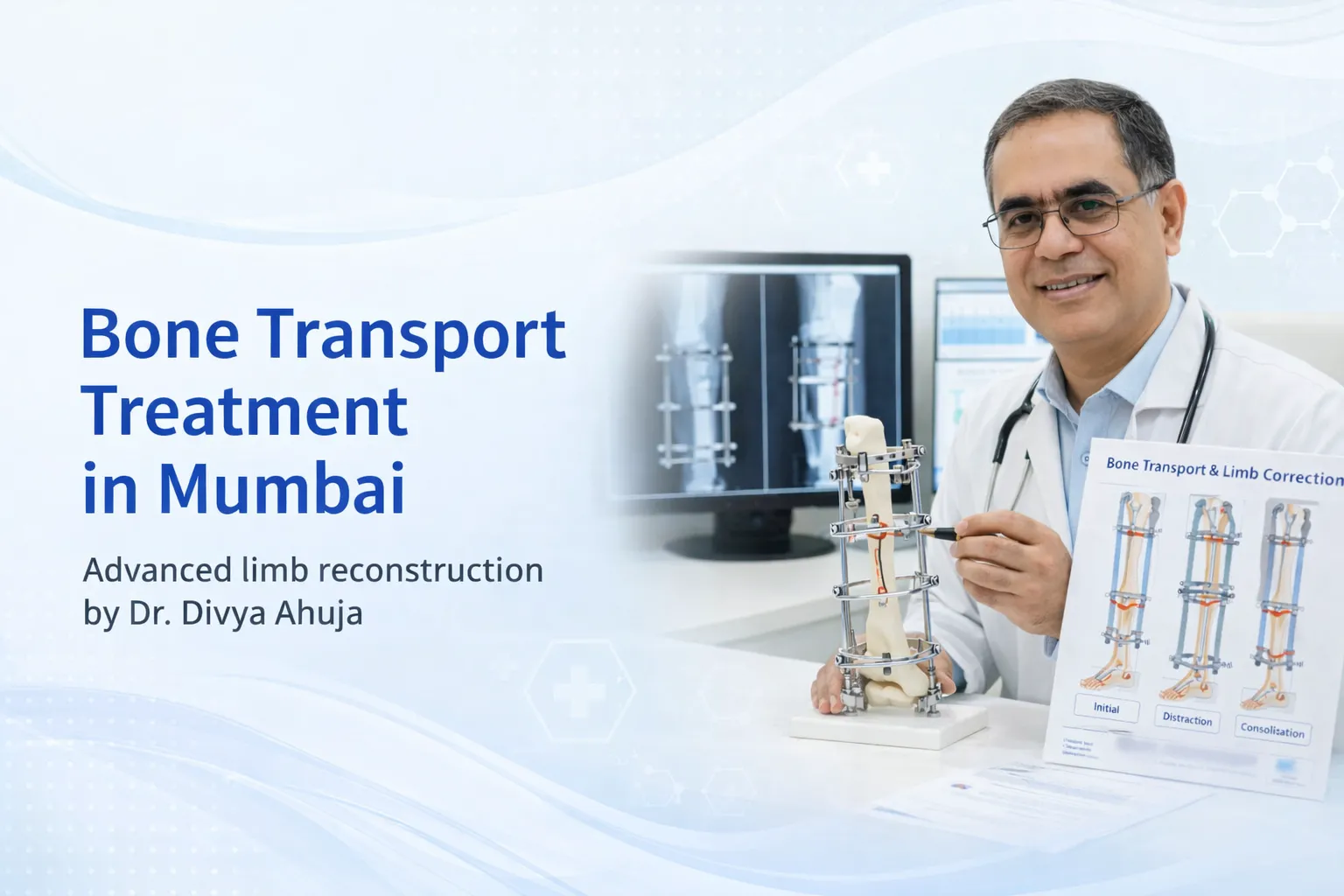Bone Transport Treatment in Mumbai