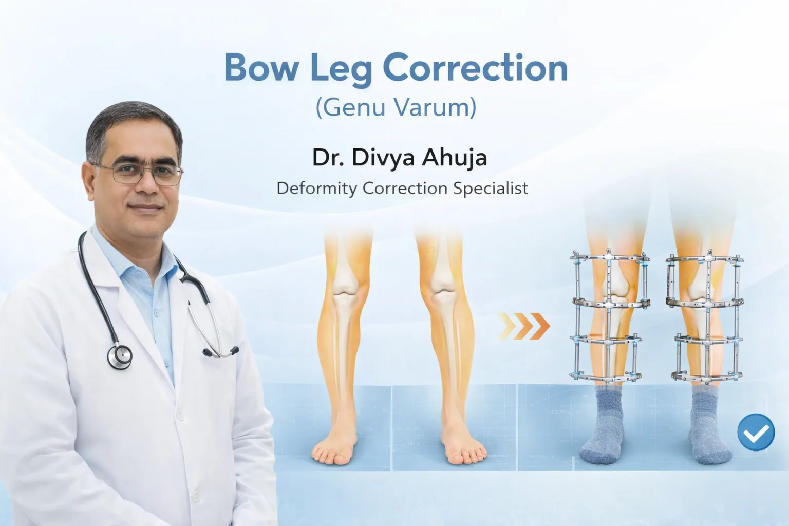 Bow Leg Correction Treatment in Mumbai By Dr Divya Ahuja