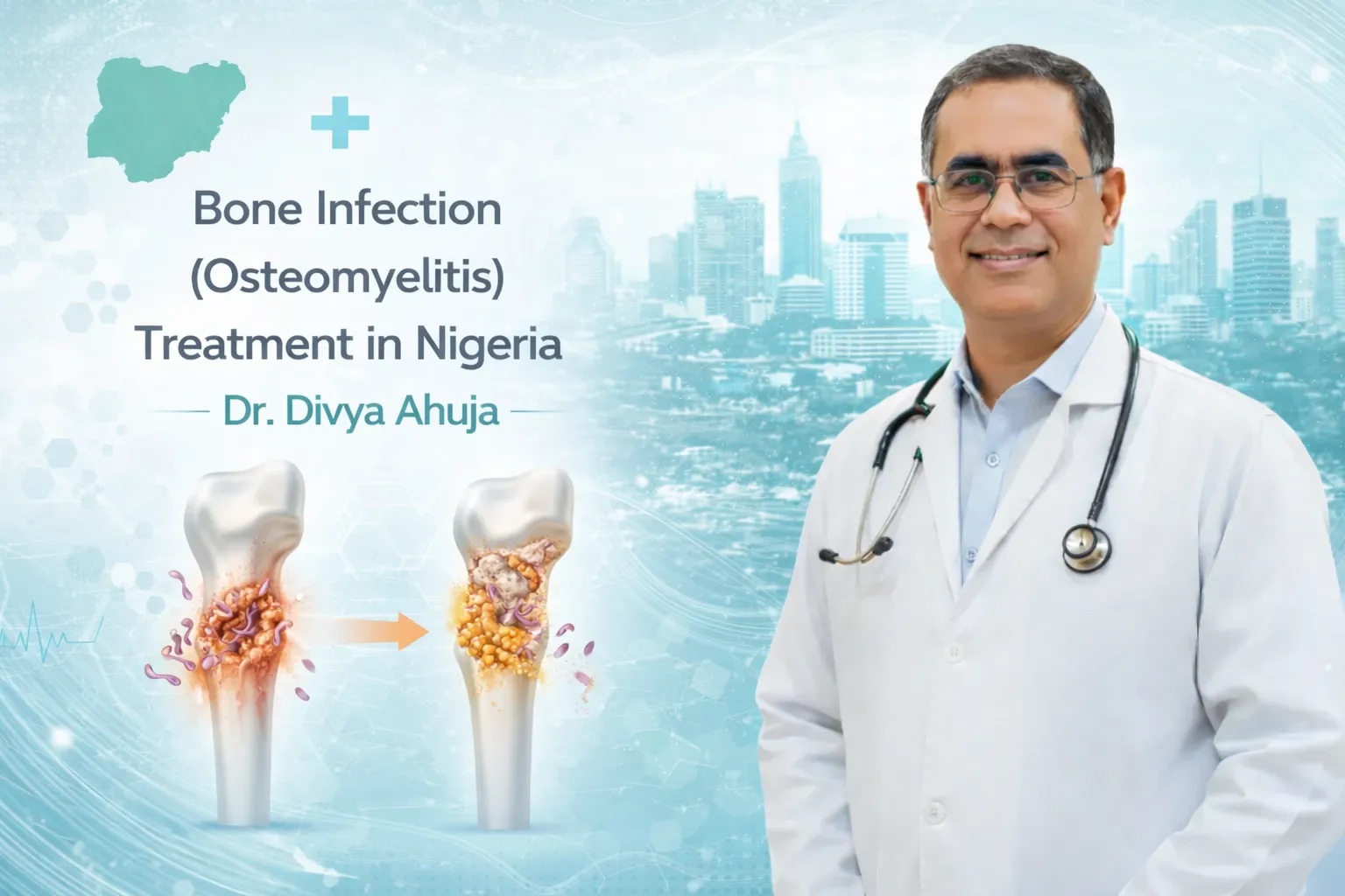 Bone Infection Treatment in Nigeria (Osteomyelitis) – Dr. Divya Ahuja