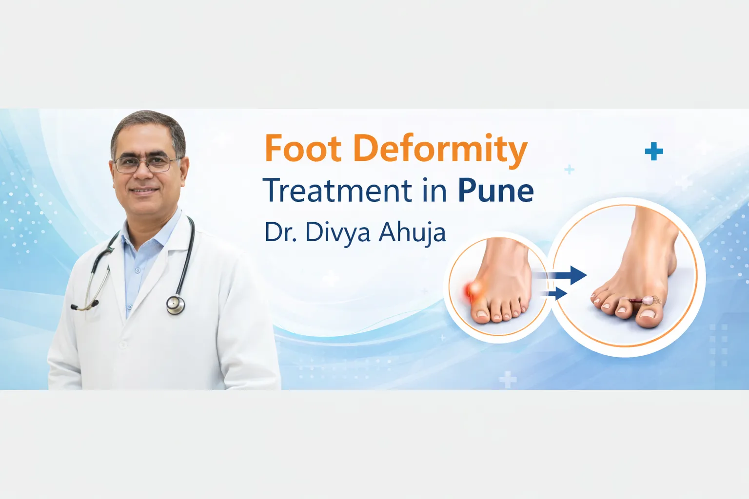 Foot Deformity Treatment in Pune – Dr. Divya Ahuja
