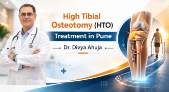 High Tibial Osteotomy (HTO) Treatment in Pune | Dr Divya Ahuja