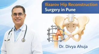 Ilizarov Hip Reconstruction Surgery in Pune | Dr Divya Ahuja