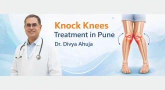 Knock Knees Treatment in Pune (Genu Valgum) – Dr. Divya Ahuja