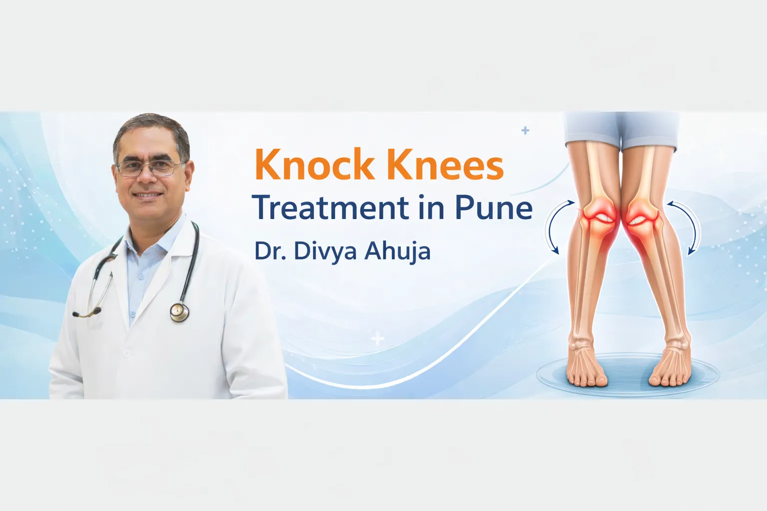 Knock Knees Treatment in Pune (Genu Valgum) – Dr. Divya Ahuja
