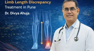 Limb Length Discrepancy Treatment in Pune – Advanced Limb Reconstruction Care - Dr Divya Ahuja